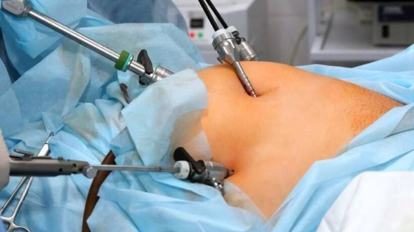 Best Laparoscopic Surgery Hospital in Thanisandra